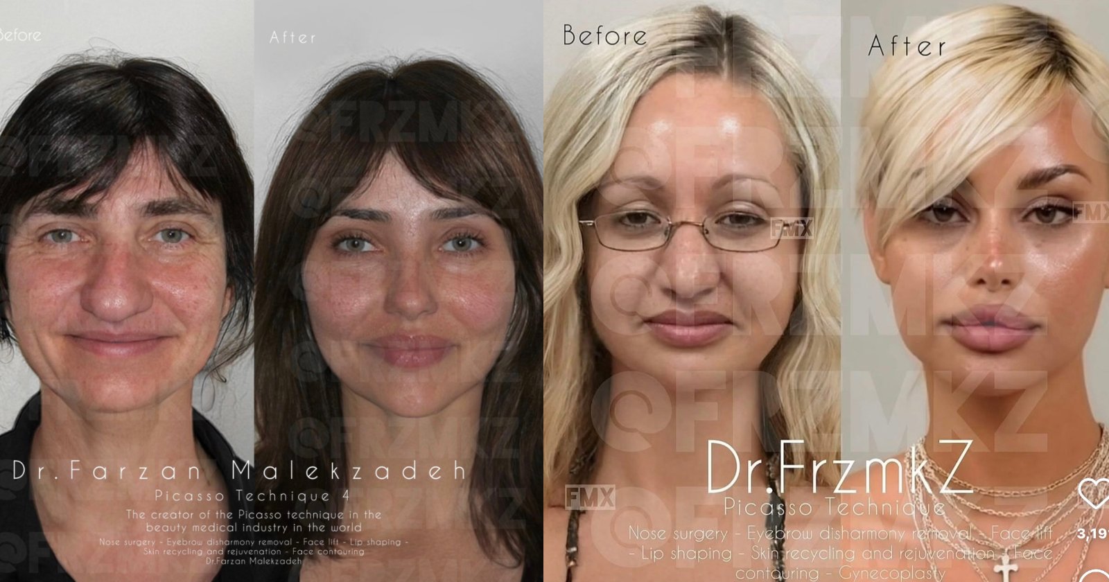 Plastic Surgeon Accused of Editing Viral Before-and-After Images of Clients