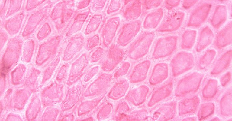 Scientists Warns That AI Images May Cause Havoc in Medical Research