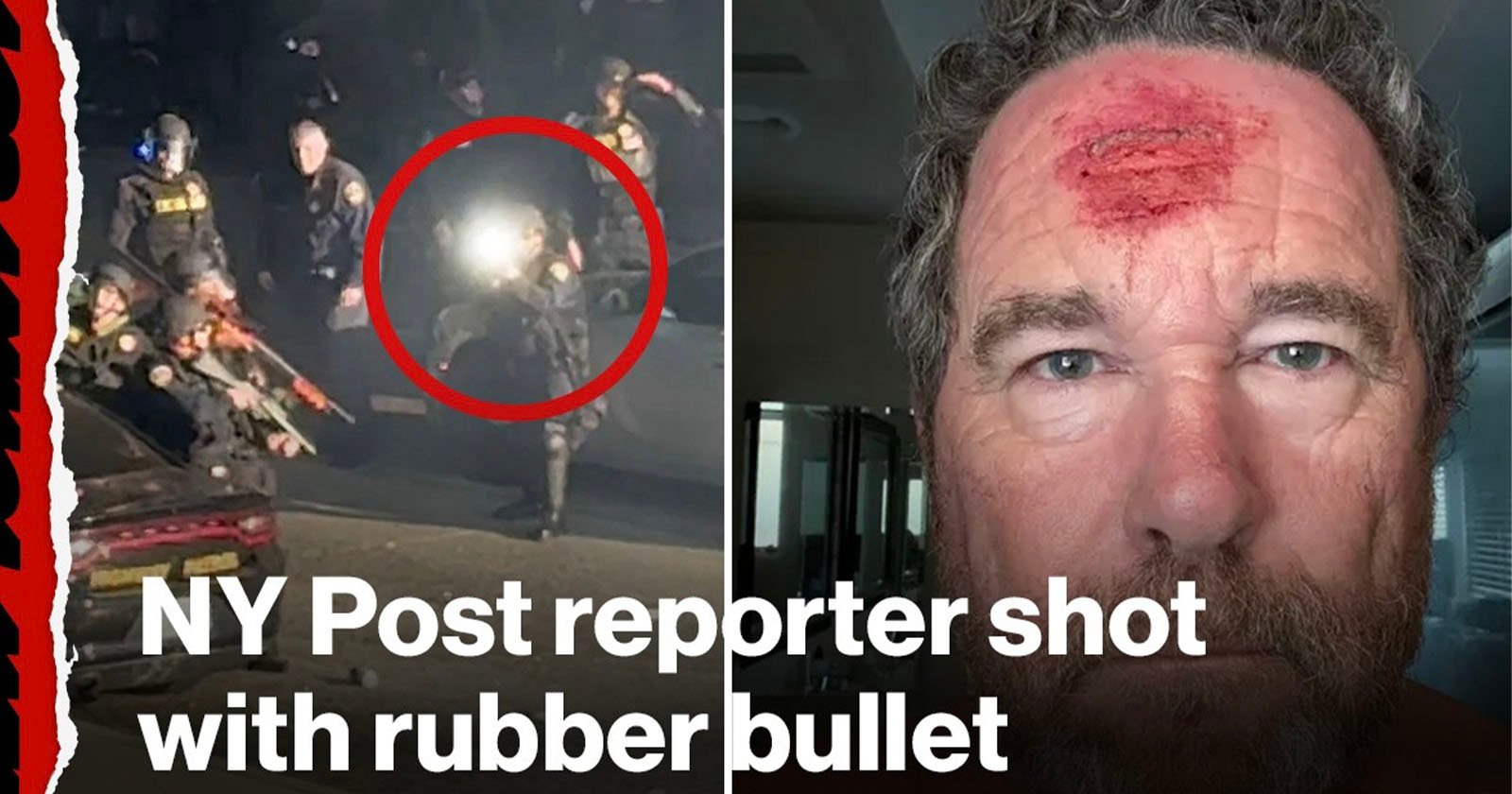 Photographer Records Himself Getting Shot in the Head by Rubber Bullet at LA Protests Photographer Records Himself Getting Shot in the Head by Rubber Bullet at LA Protests