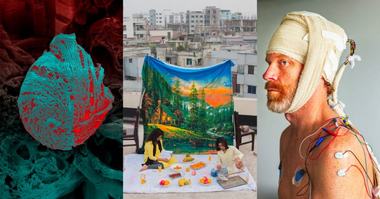 The 25 Finalists of the Wellcome Photography Prize Where Each Winner Receives $13,500