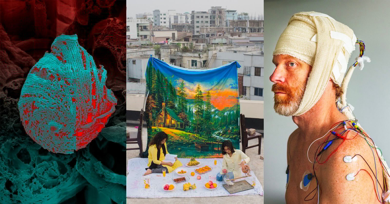 The 25 Finalists of the Wellcome Photography Prize Where Each Winner Receives $13,500 The 25 Finalists of the Wellcome Photography Prize Where Each Winner Receives $13,500