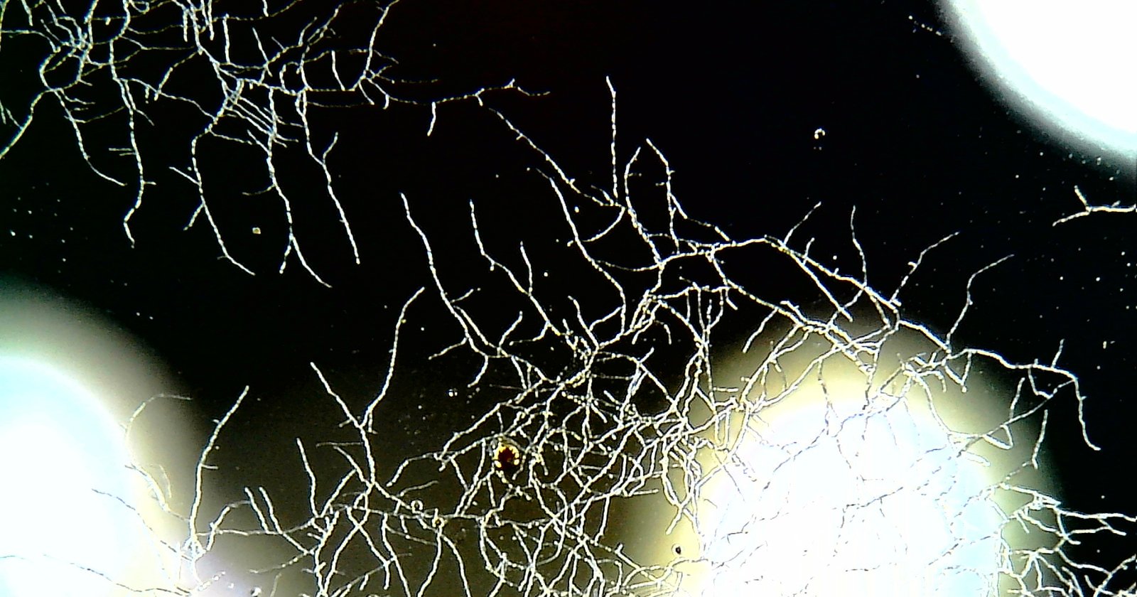 Lens Fungus: What It Is and How to Deal With It