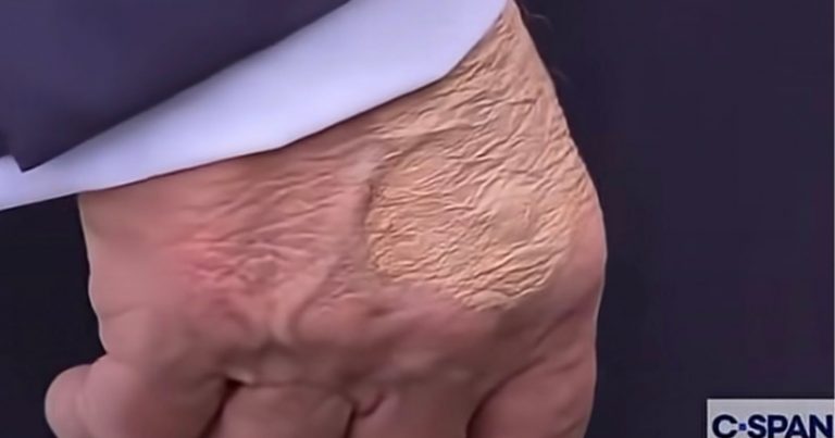 Camera Operator’s Zoomed in Shot of Trump’s Hand Goes Viral