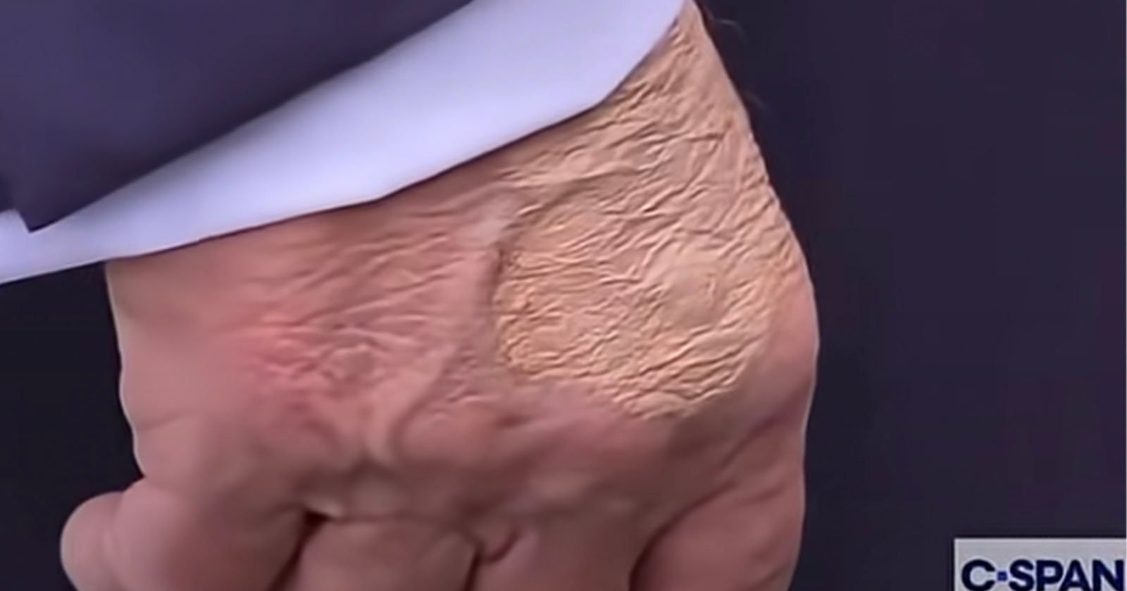 Camera Operator’s Zoomed in Shot of Trump’s Hand Goes Viral