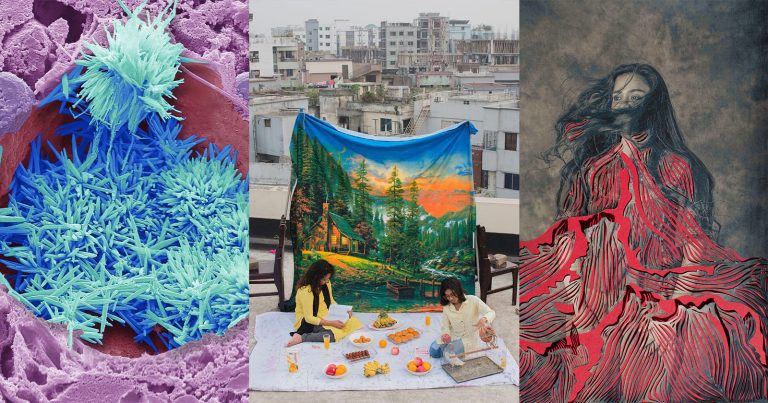 The Wellcome Photography Prize 2025 Announces its Three Winners