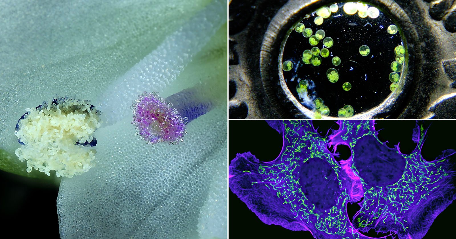 Nikon Small World in Motion Winners Reveal Hidden Microscopic Wonders Nikon Small World in Motion Winners Reveal Hidden Microscopic Wonders